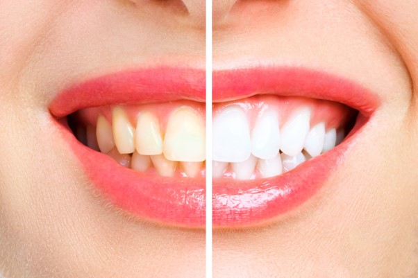 Sreshta Dental, Dr. Pavan Preetham